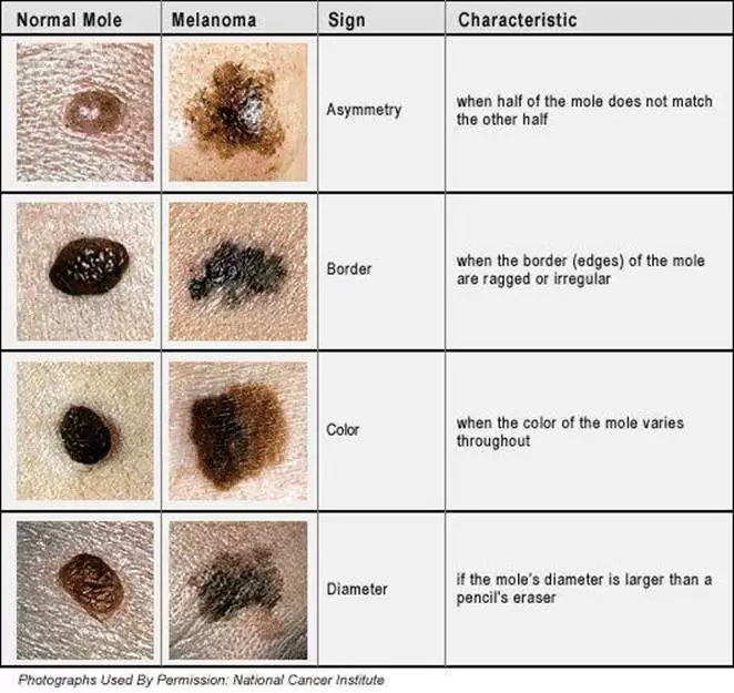 Skin Cancer Awareness